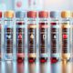 Blood Test for Wellness in Borehamwood: Your Health Checkup