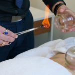 Cupping Therapy: Discover Healing Benefits in Melbourne
