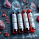 Cholesterol Blood Test Tips for Yeovil Residents